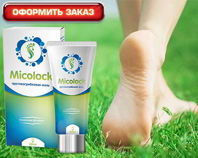 Миколок купить