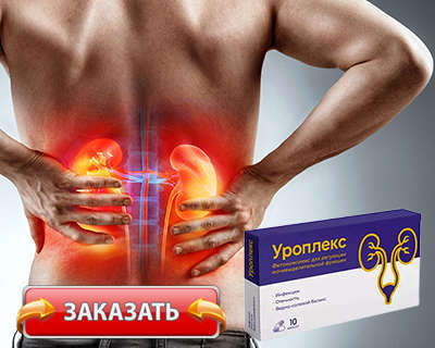 Препарат Уроплекс купить по доступной цене.